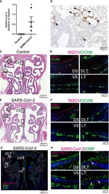 Oral SARS-CoV-2 Inoculation Causes Nasal Viral Infection Leading to Olfactory Bulb Infection: An Experimental Study